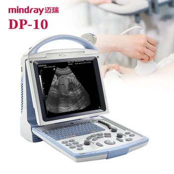Портативный ультразвуковой сканер mindray DP-10 по хорошей цене / аппарат для ультразвуковой терапии mindray